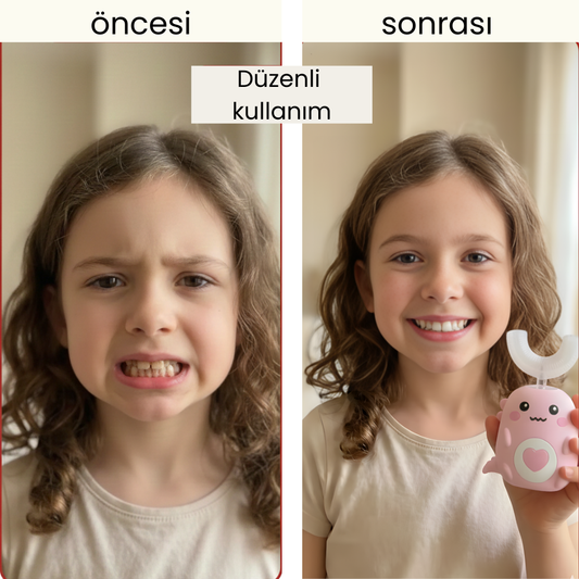 Dentivo 360° Akıllı Çocuk Diş Fırçası